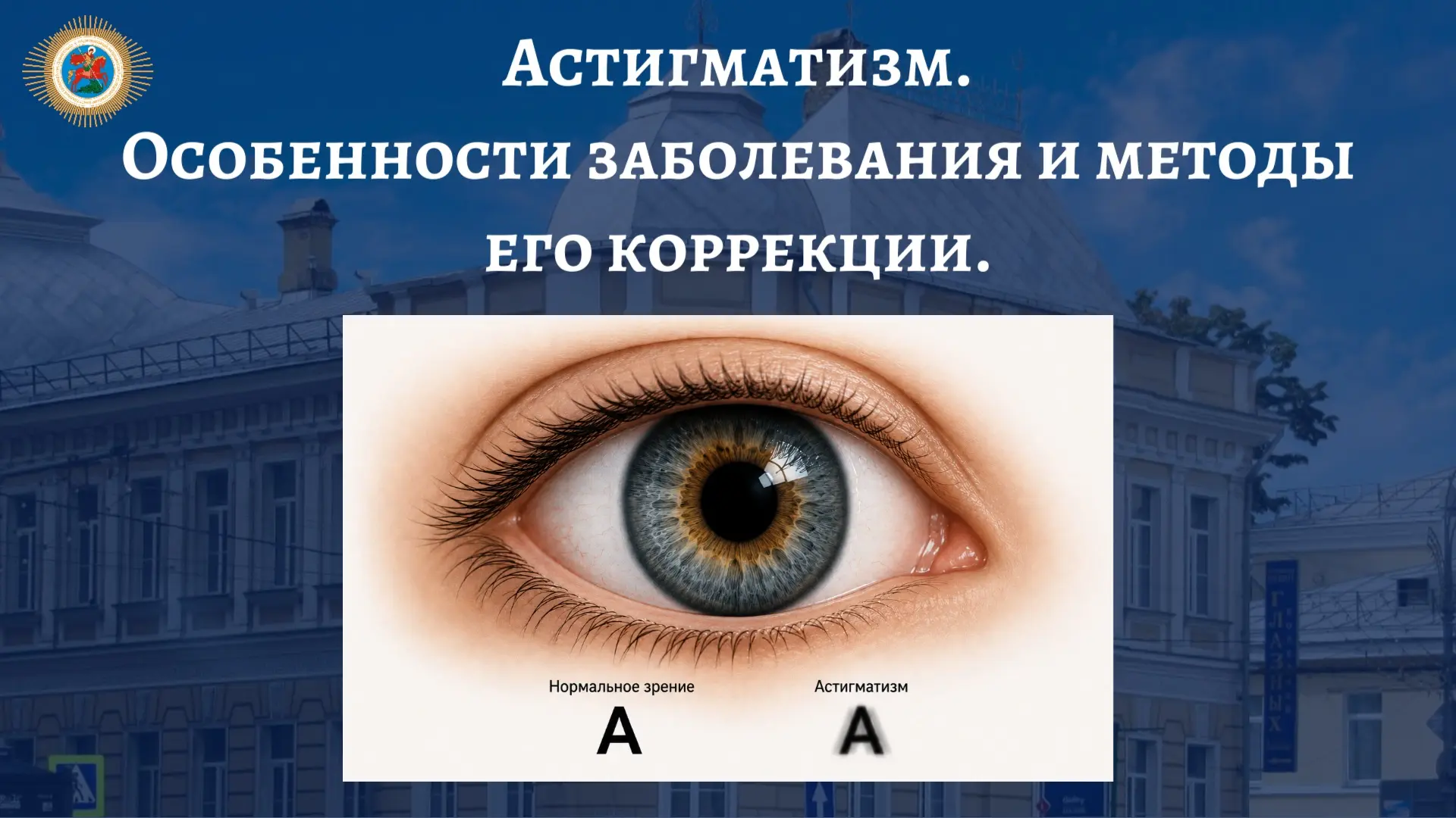 ⚡Астигматизм - особенность строения оптического аппарата глаза.