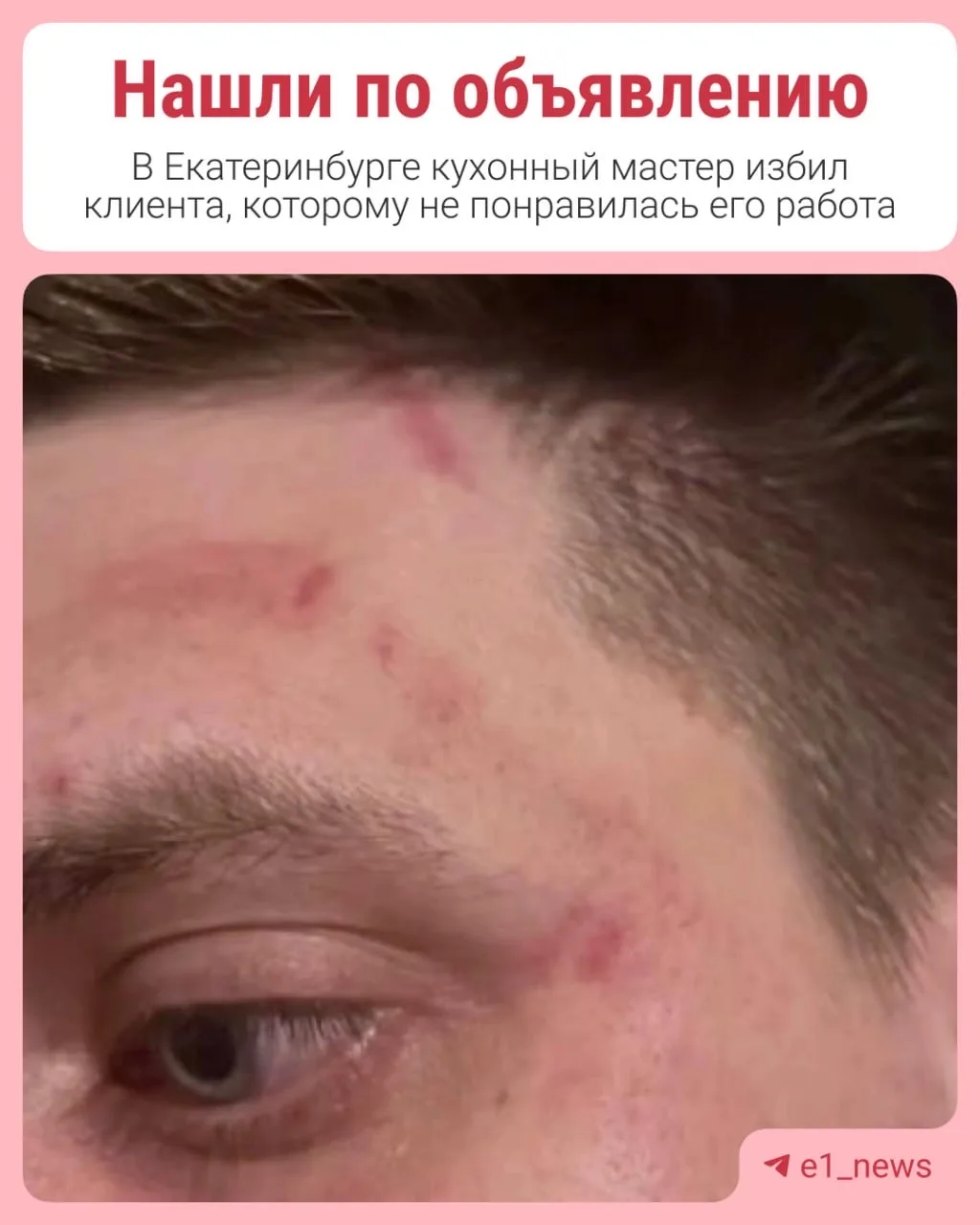 Кухонный мастер избил клиента, которому не понравилась его работа  Екатеринбурженка Вероника заказал