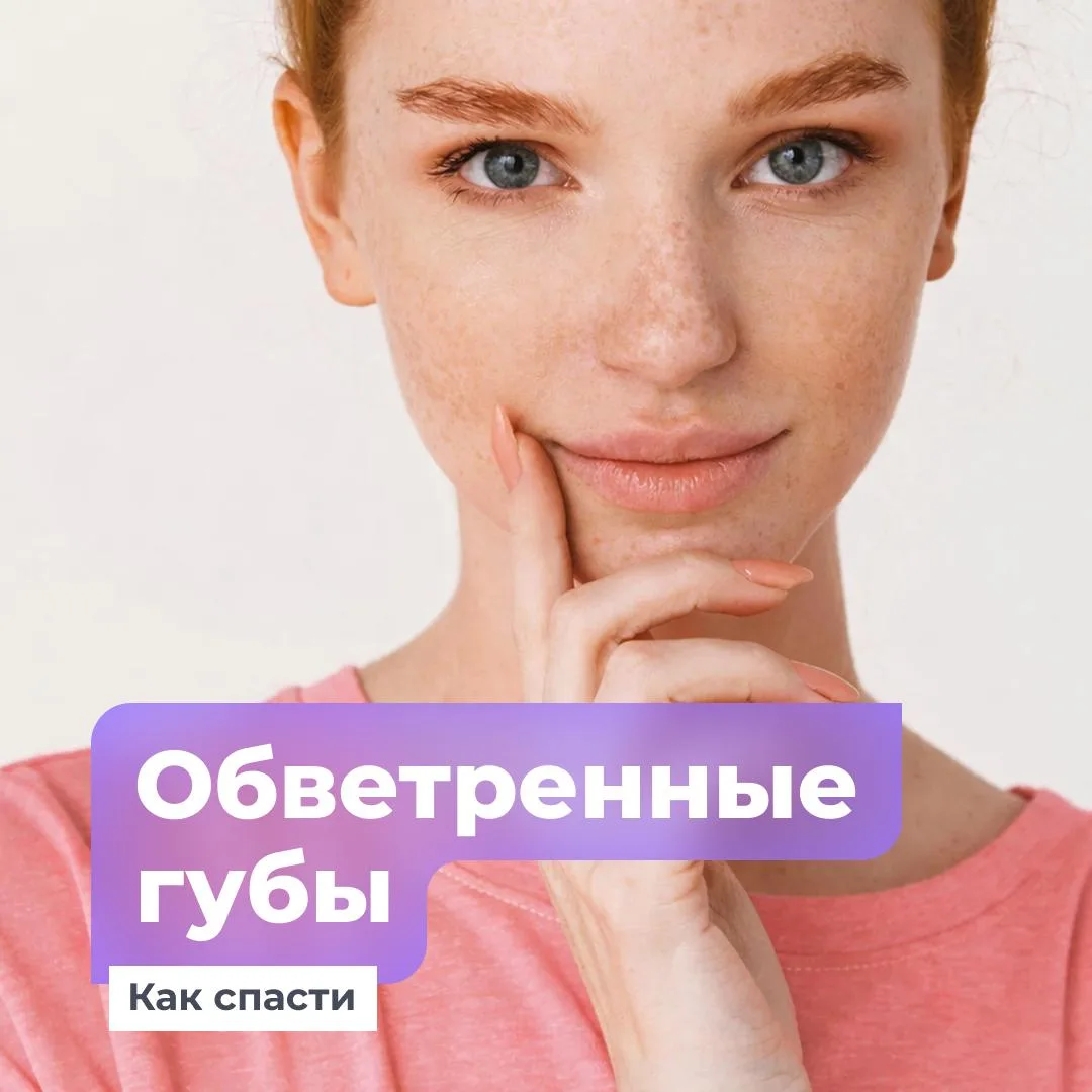 🥶 Сухость, шелушение и трещинки на губах. Знакомая история в холодное время года?