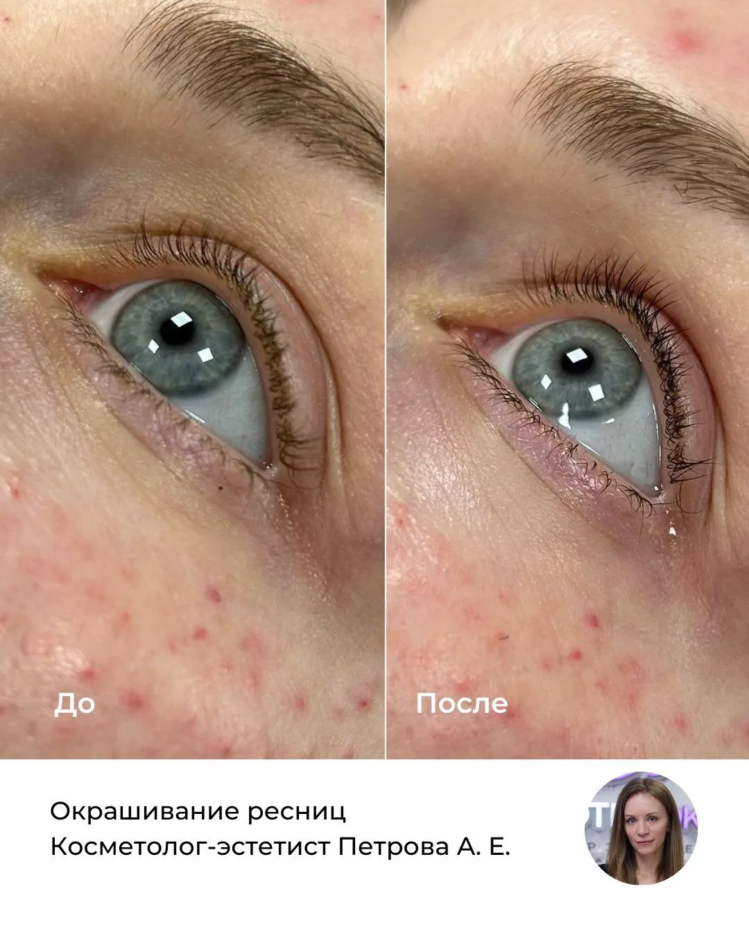 Иногда самые заметные изменения складываются из небольших деталей ✨

После профессионального ухода к