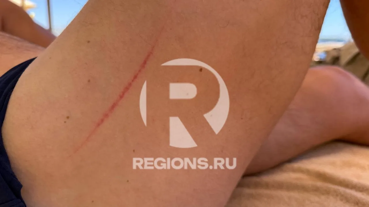 Скальпель в хвосте: рыба-хирург атаковала жителя Одинцова в Египте