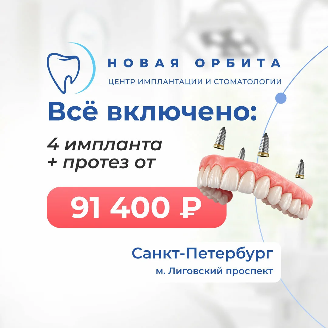 Все зубы сразу на 4 имплантах от 91.400 ₽ в Петербурге!  Центр имплантации зубов «Новая Орбита», м. 