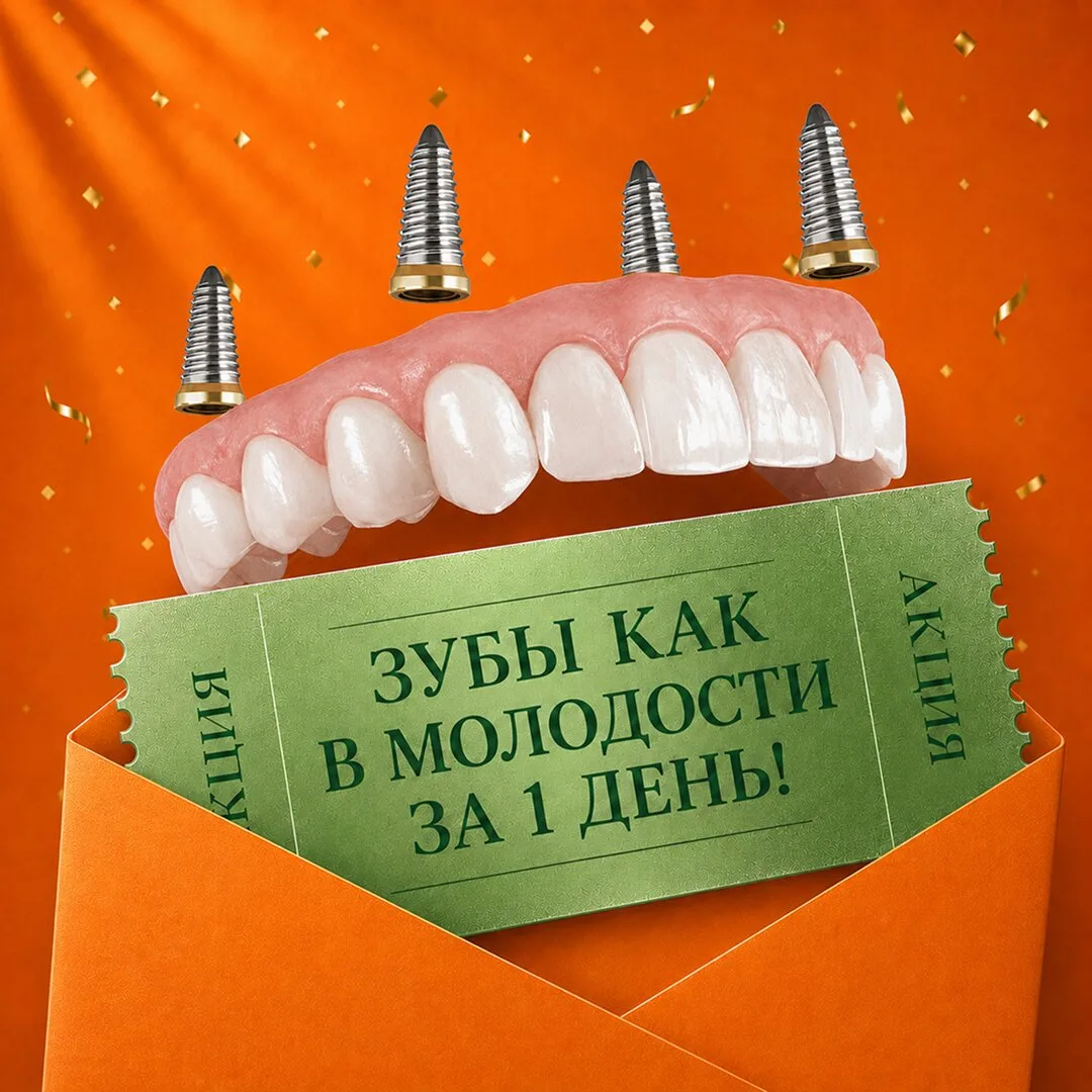 Все зубы на 4-х в Оренбурге: установка с 3D-шаблоном!