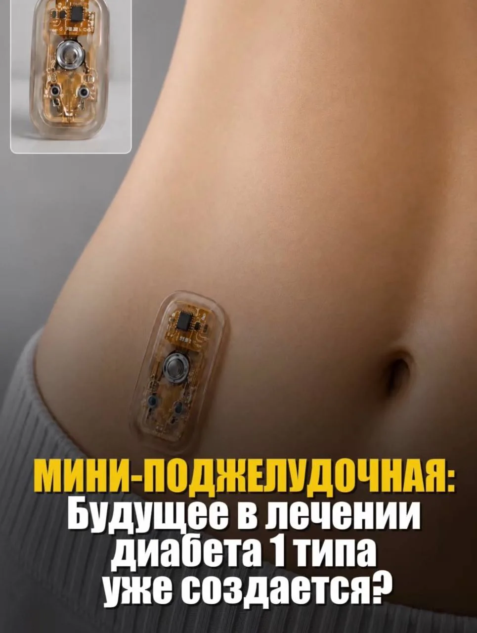 Ученые сделали важнейший шаг к тому, чтобы навсегда изменить подход к лечению диабета 1...
