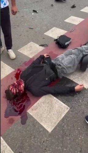 18+. В Москве курьер разбил себе все лицо, пытаясь доставить заказ как можно быстрее.