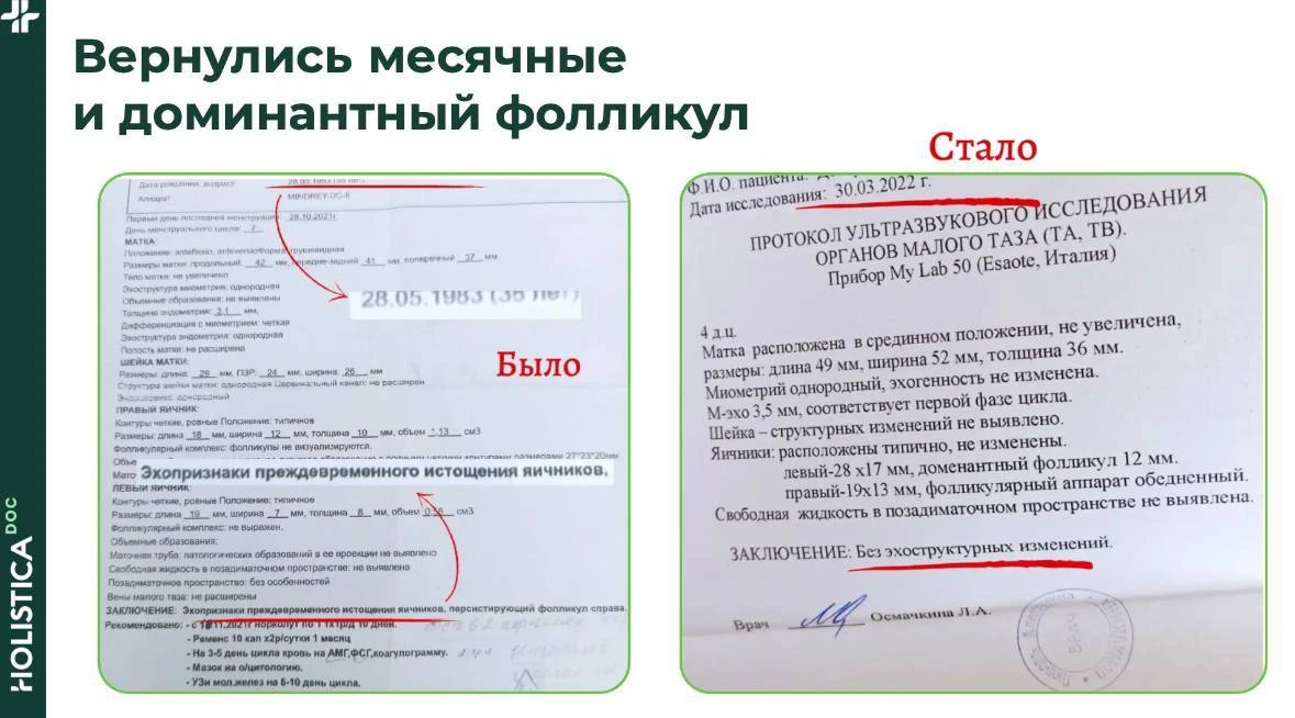 ☕️ Напиток, который сжигает жир, пока вы сидите на диване