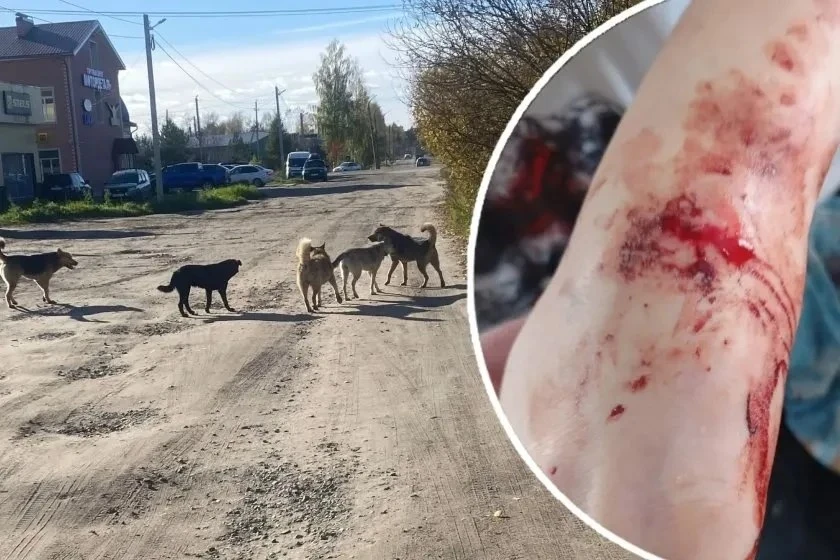 🐕 В Шарье проверяют сообщения о нападениях бездомных собак на детей.