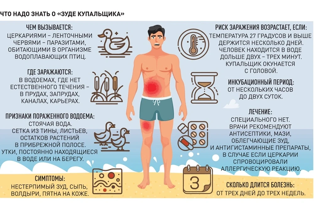 Церкариоз, шистосомный дерматит или «зуд купальщиков»