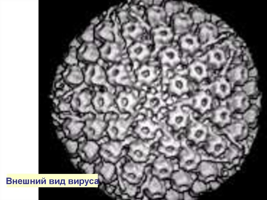 Болезнь Ауески (Morbus Aujeszky, псевдобешенство, инфекционный бульбарный паралич, инфекционный мени