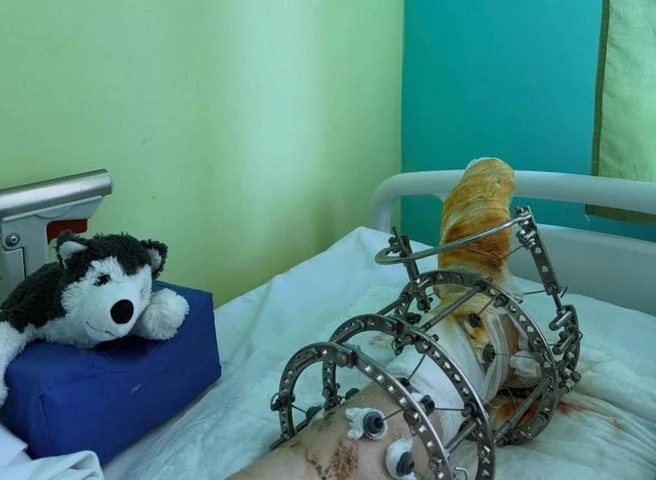 «Снова начал смеяться в голос»: школьник, которого зажевал аттракцион в Стерлитамаке, медленно идет 