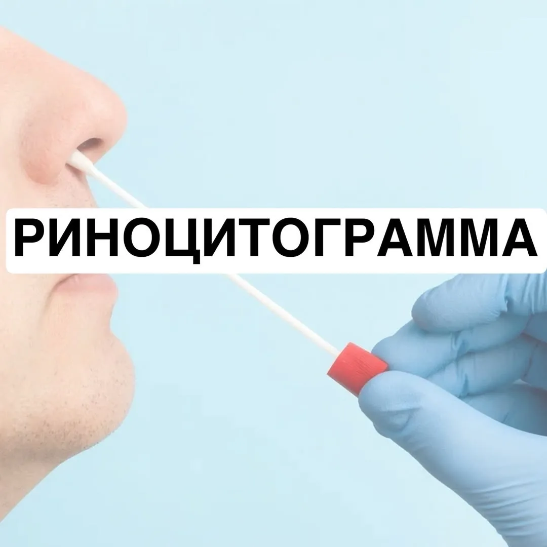 Риноцитограмма — микроскопическое исследование секрета слизистой оболочки носа, достато...