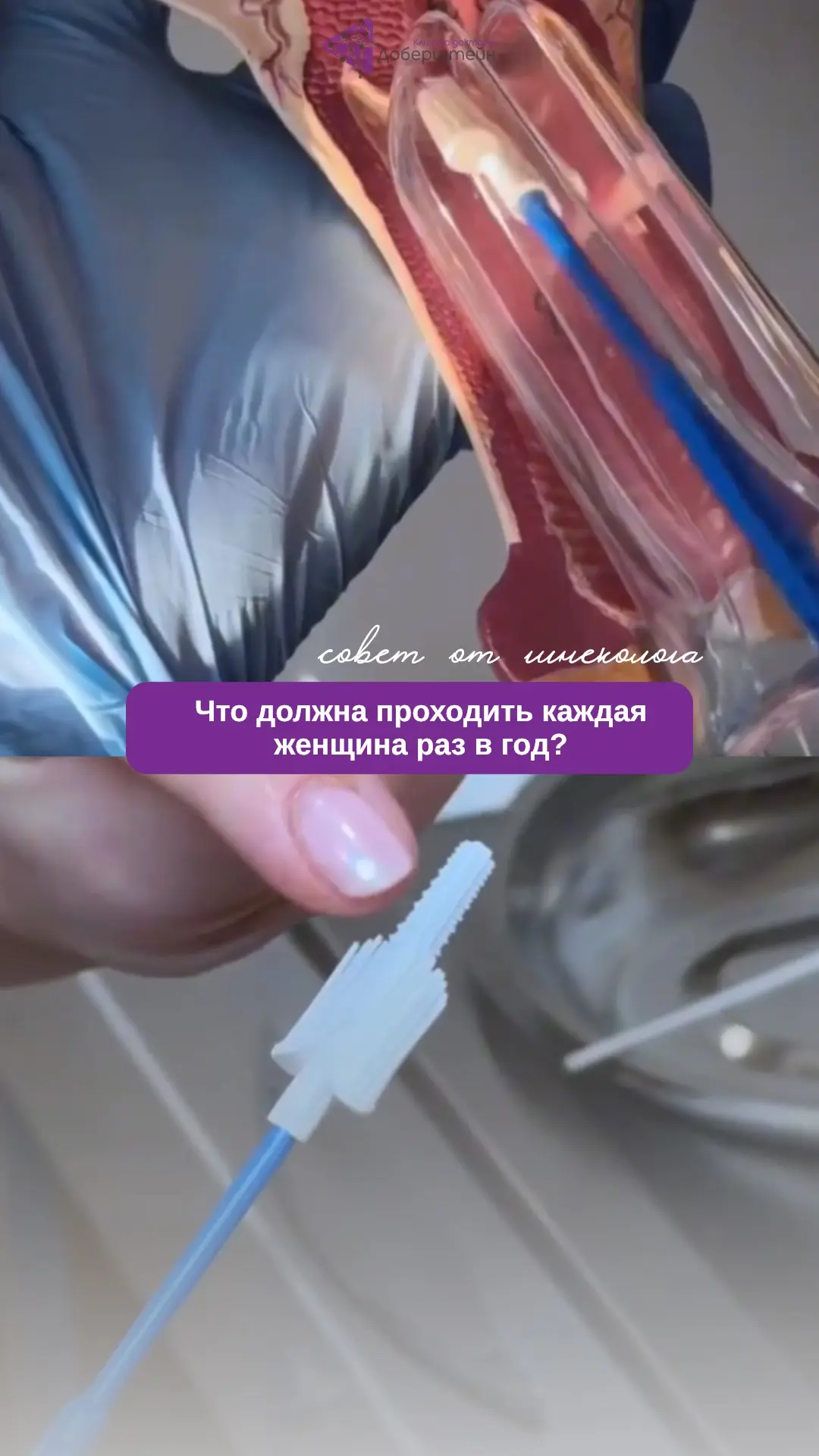 Что каждая женщина должна обязательно проходить ежегодно? 

Об этом рассказывает наш врач-гинеколог 