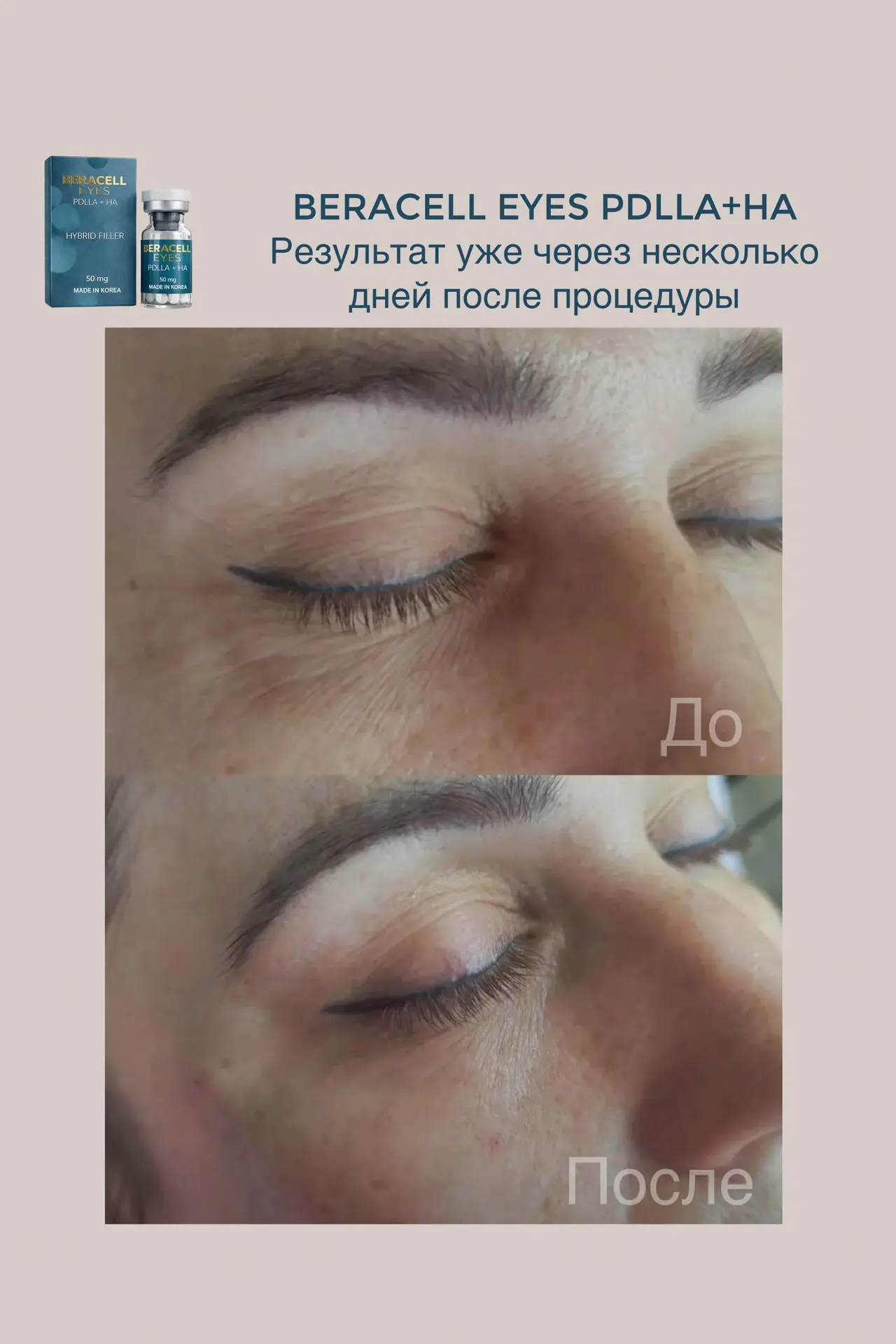 Коллеги, работа Шпаковской Виктории из Ростова-на-Дону😍.