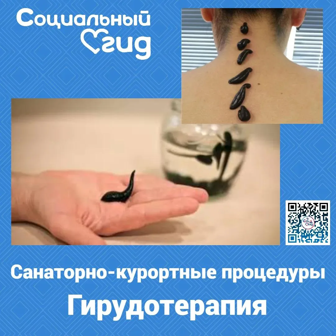 Гирудотерапия — лечение с помощью медицинских пиявок (Hirudo medicinalis)

Гирудотерапия объединяет 