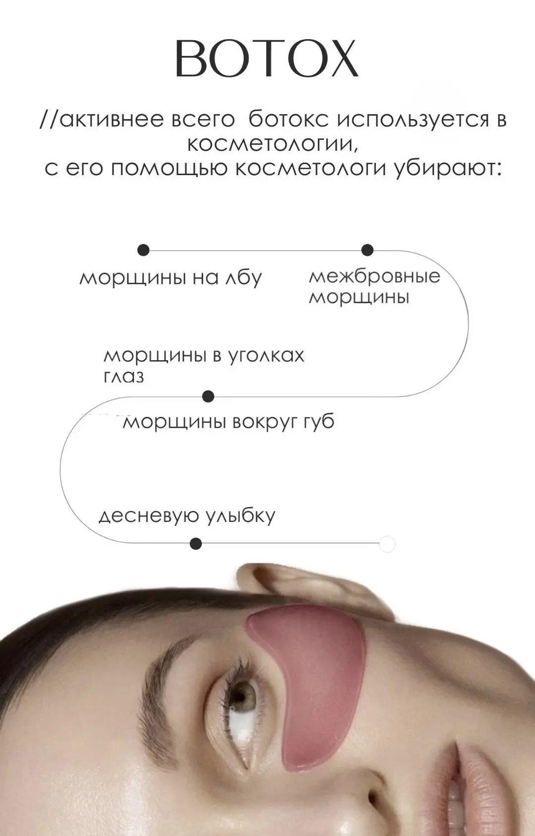 На сегодня к 18.30 горит 🔥 окошко на ботокс верхней трети . Кому подходит время пишите 👇🏻