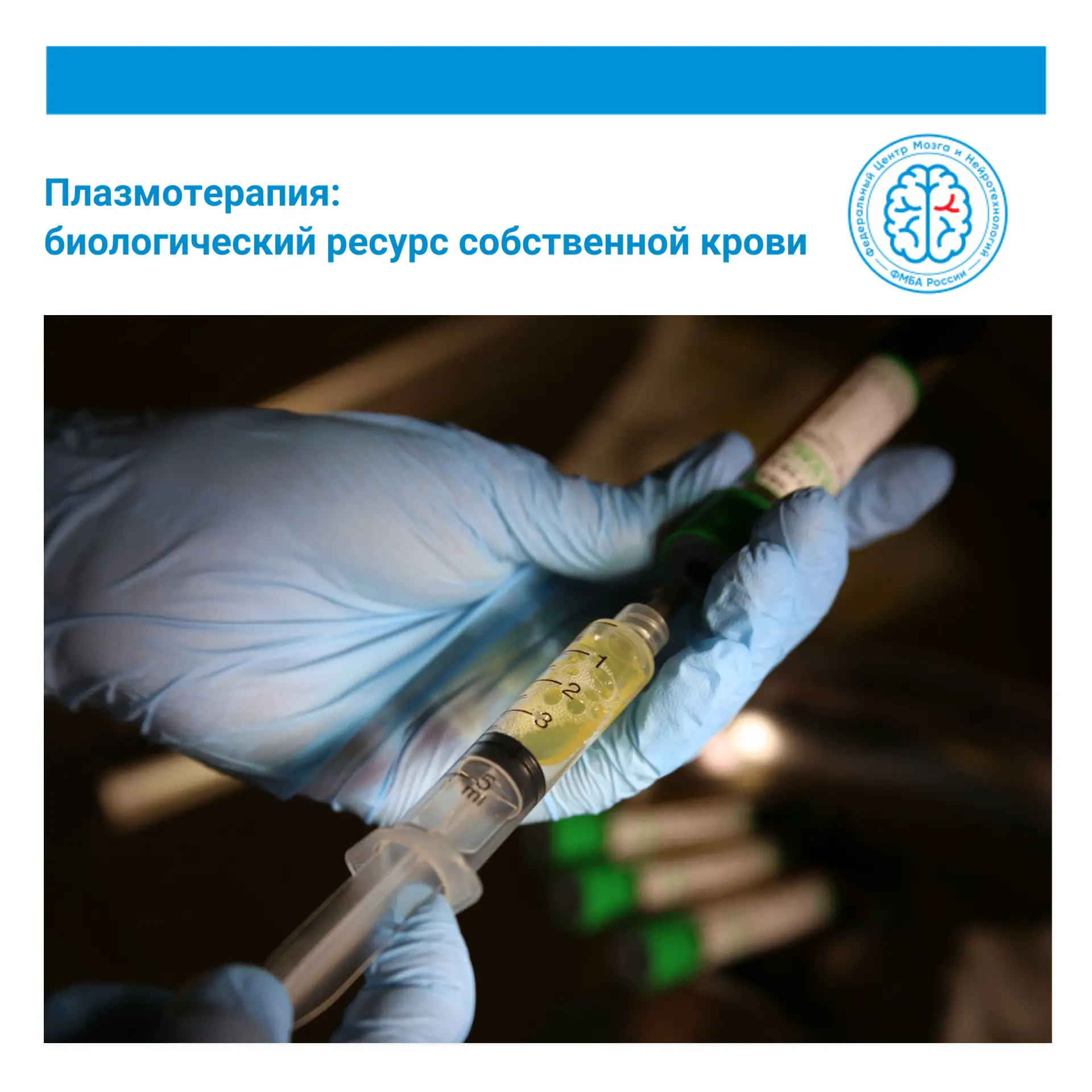 💉Плазмотерапия — инъекционная методика, при которой используется подготовленная плазма...