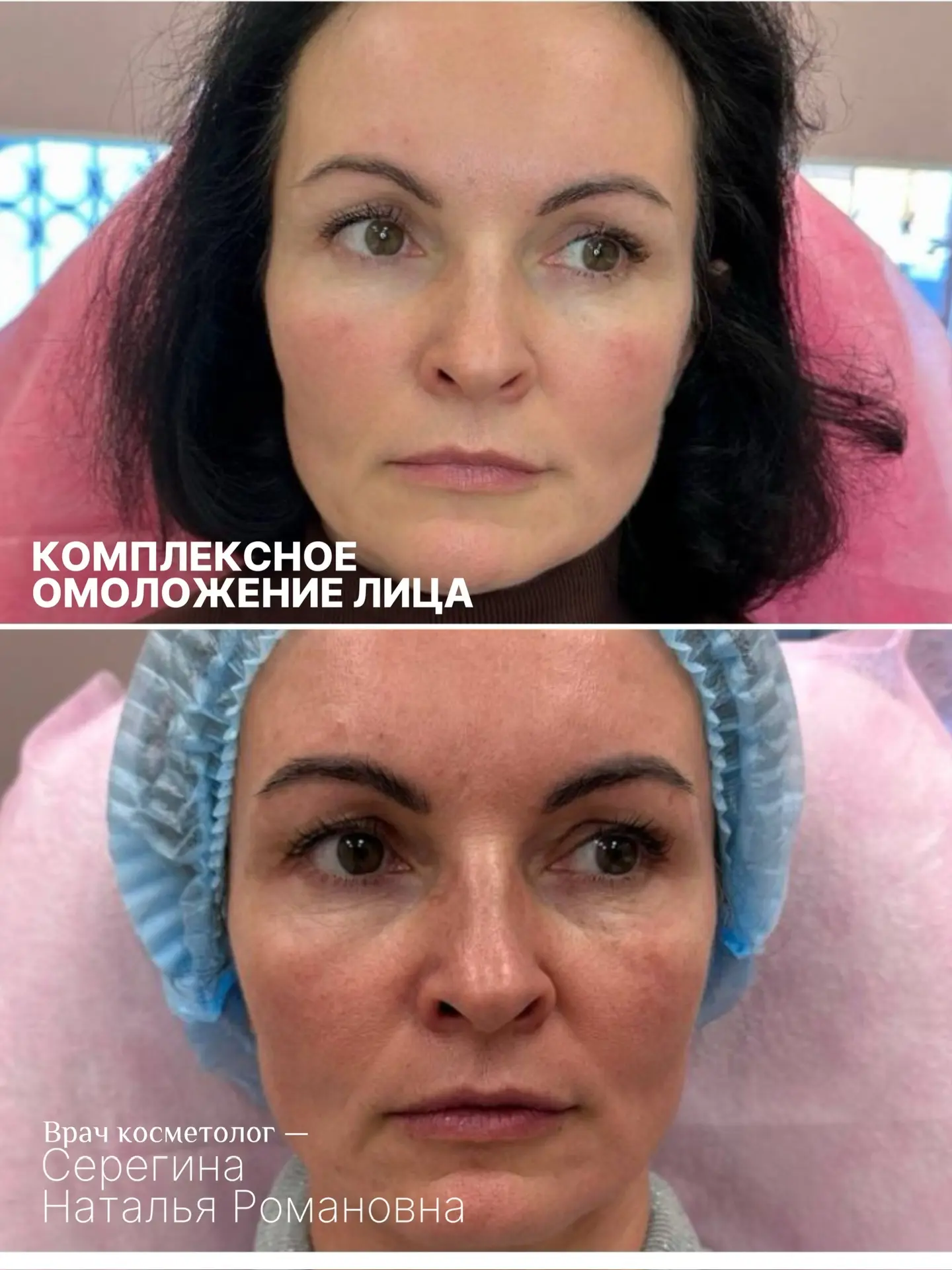 Листайте, чтобы увидеть магию косметологии🙌🏼