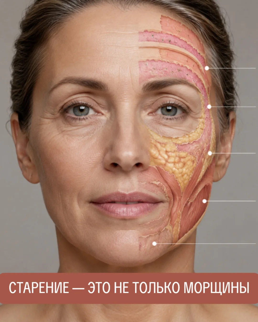 СТАРЕНИЕ — ЭТО НЕ ТОЛЬКО МОРЩИНЫ.