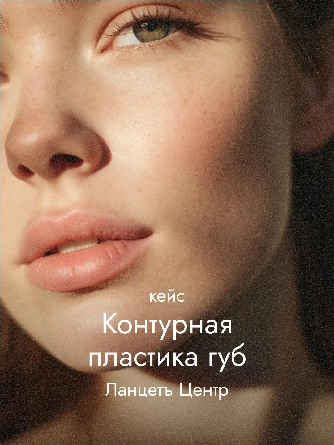 Губы — зона, где результат виден сразу. Четкий контур, естественный объем, ухоженная кожа.