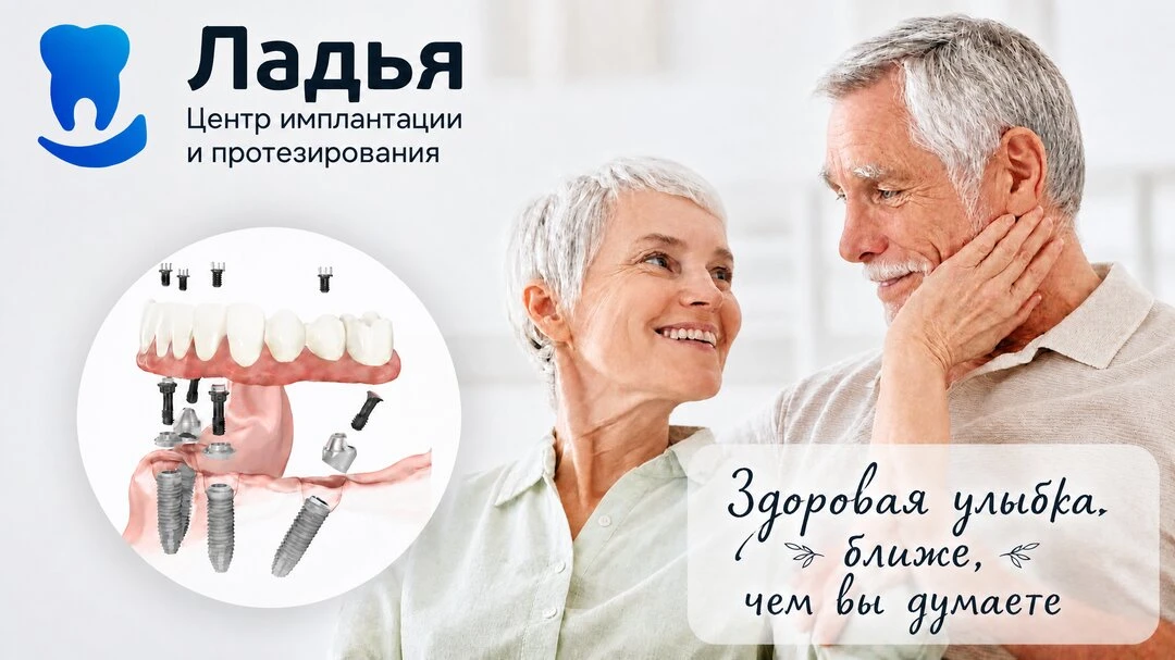 Имплантация всех зубов в Самаре! за 1 день
