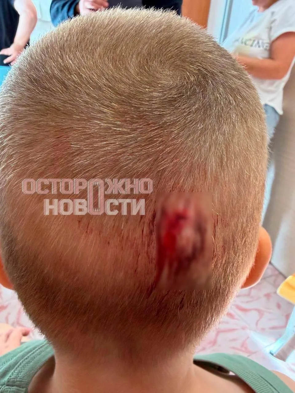 На детей упал шкаф в детском саду Томска