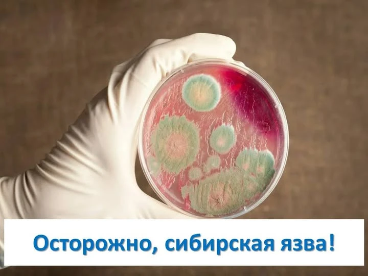 Сибирская язва — это острая инфекционная болезнь животных и человека, возбудителем кото...