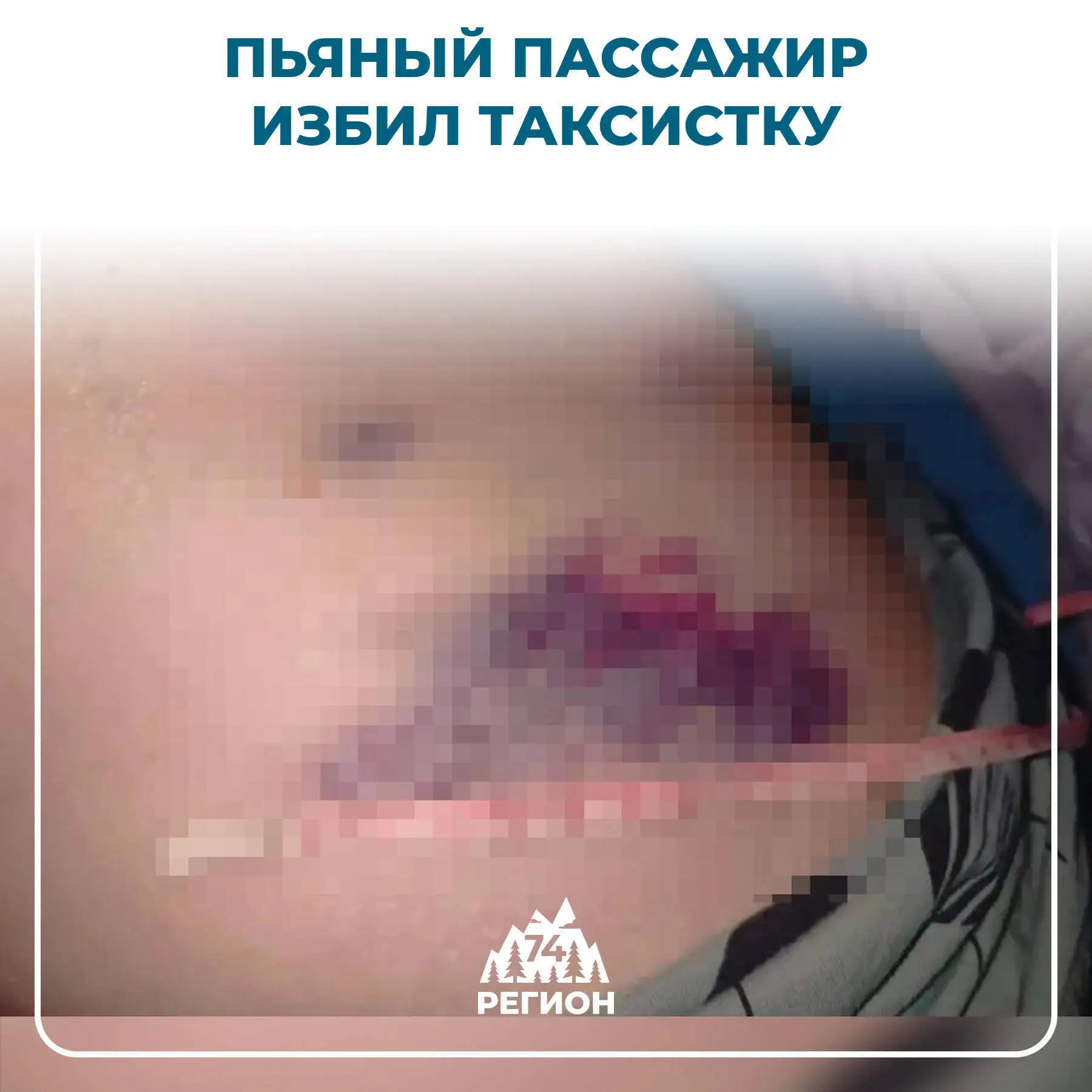 😡 Пьяный пассажир избил таксистку