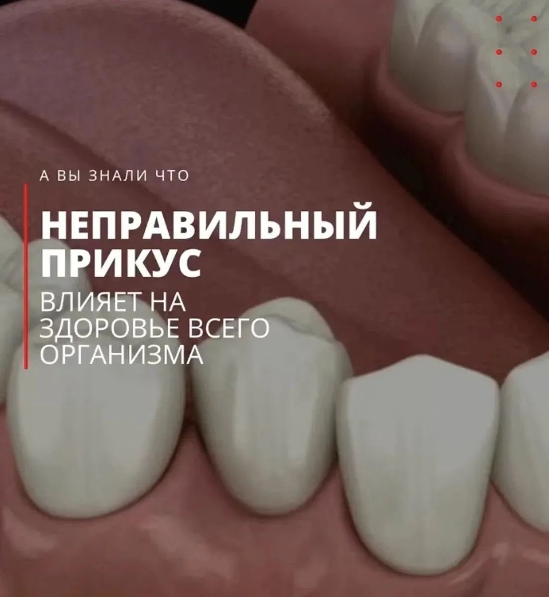 🦷 А вы знали, что неправильный прикус влияет на здоровье всего организма?

Многие считают, что непр