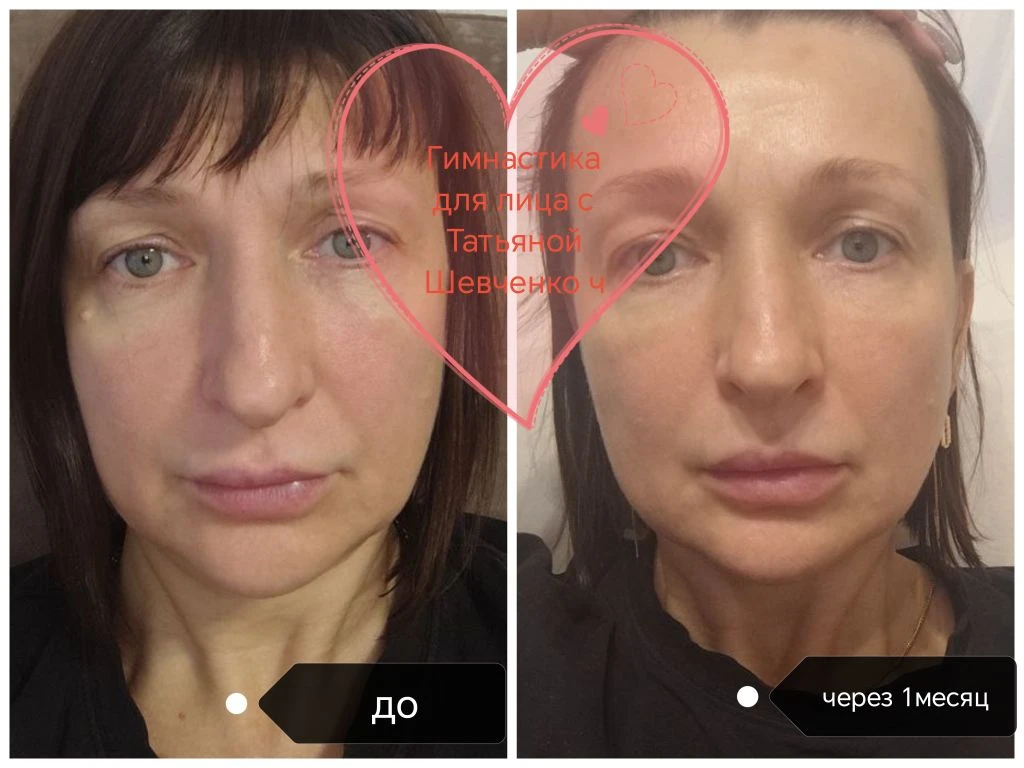 Вы терпите отёки годами? А решение есть - и оно занимает всего 3 недели