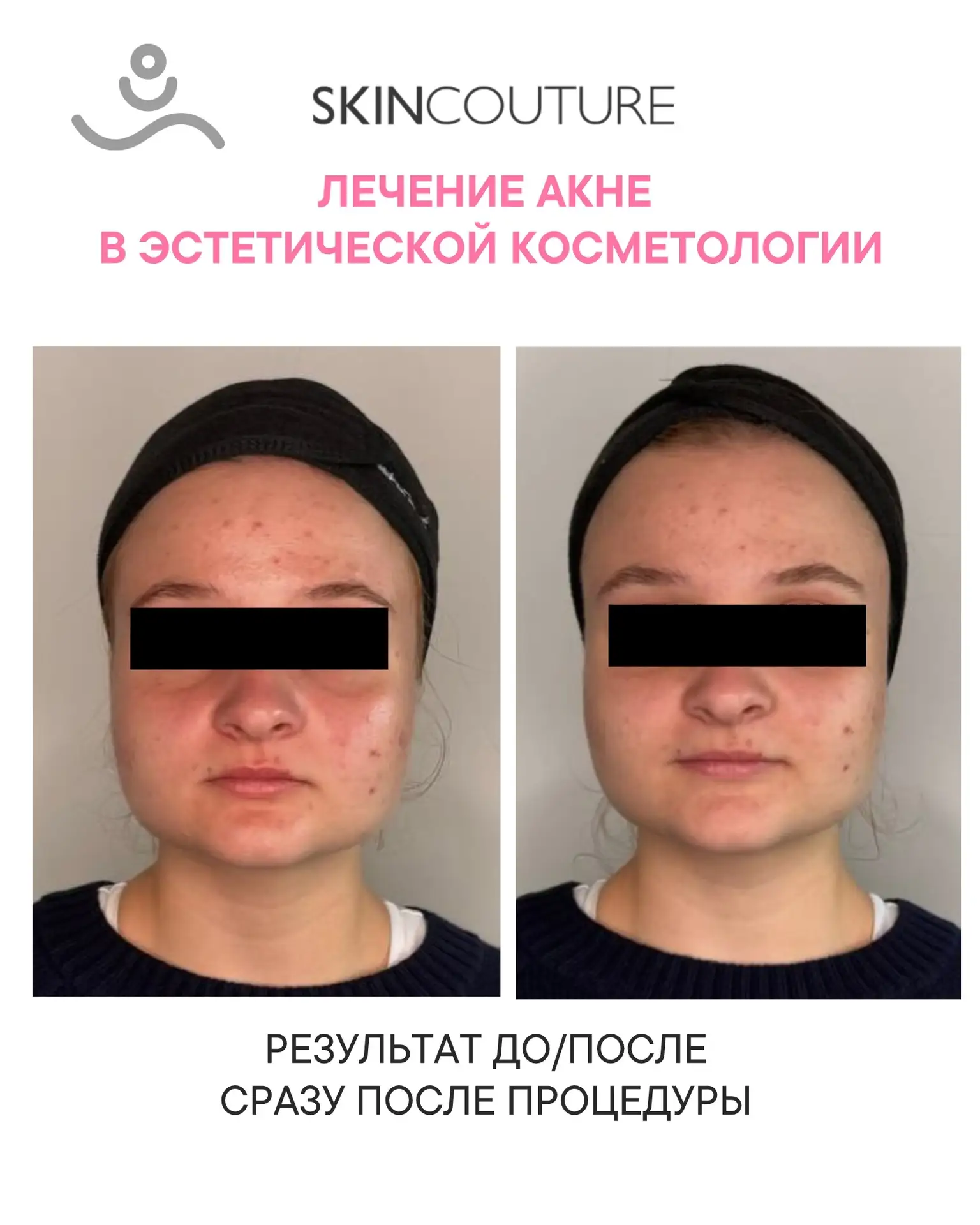 ЗАКРЫТЫЙ ТЕЛЕМОСТ ДЛЯ КОСМЕТОЛОГОВ

Коллеги, поговорим о том, о чем обычно молчат в открытых эфирах.