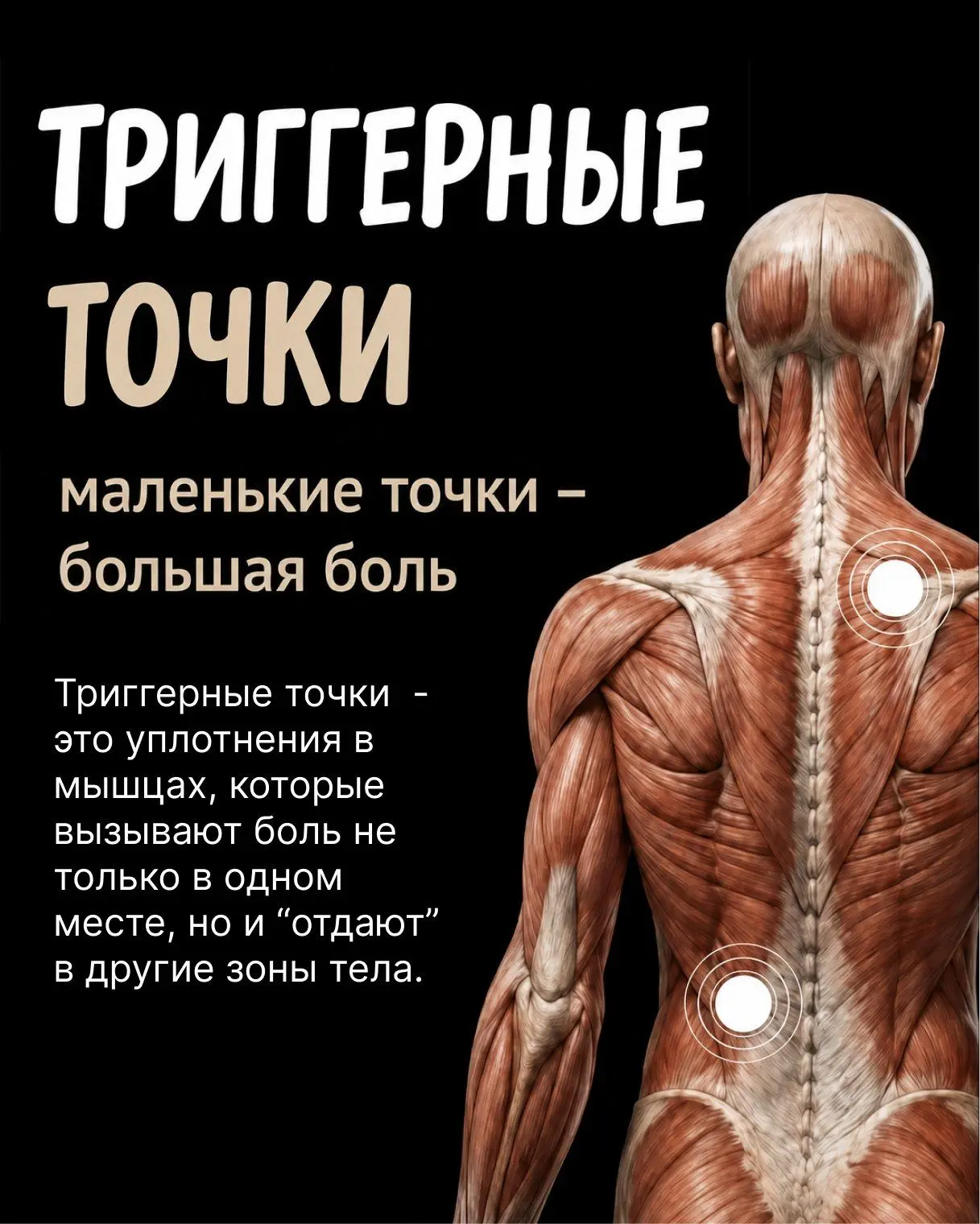 Болит в одном месте, а причина может скрываться в перенапряжённой мышце ⚡