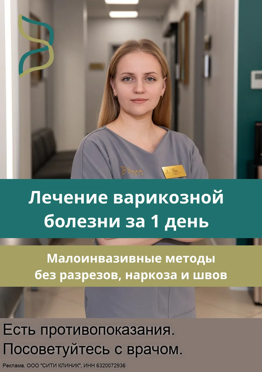 Лечение варикоза в Тольятти без операции за 1 день