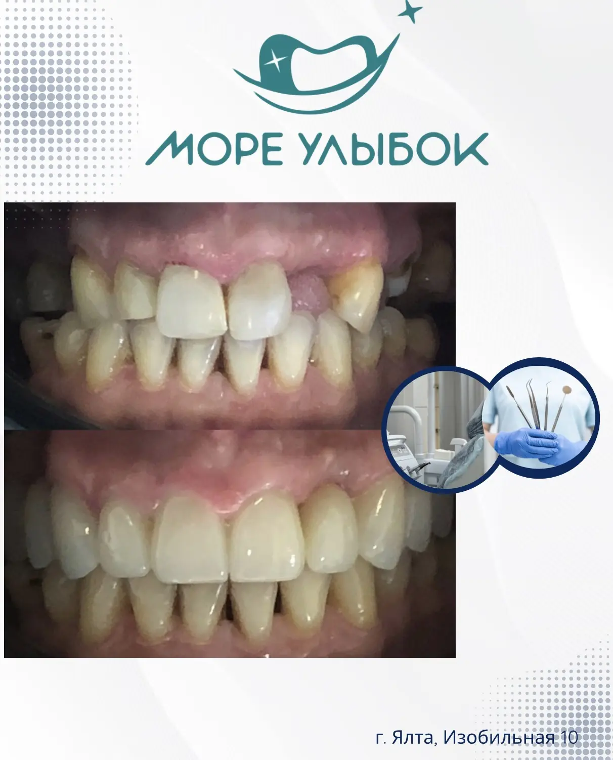✨ Красивая улыбка меняет не только внешность, но и уверенность в себе.