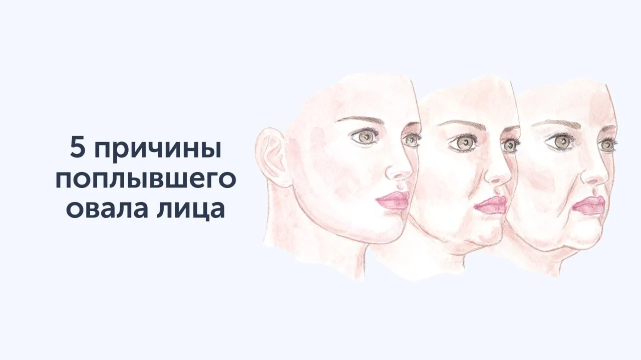 5 причин нечёткого овала лица