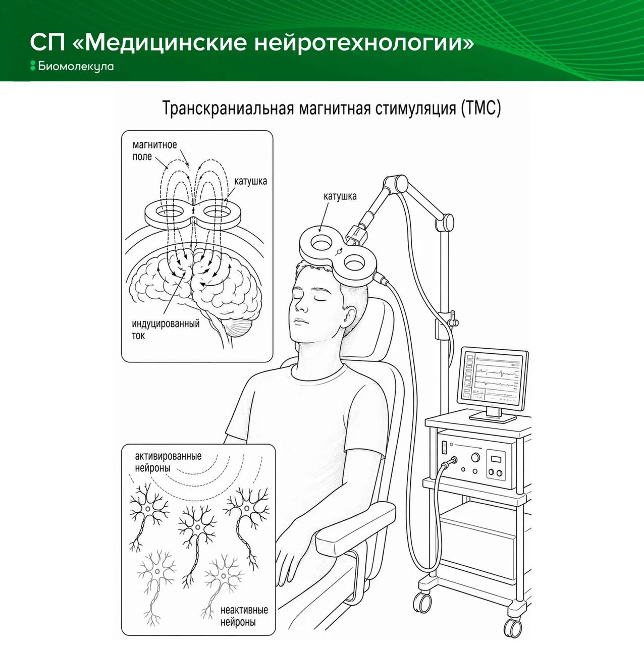 В 1980 году ученые впервые показали, что через череп можно напрямую стимулировать кору ...