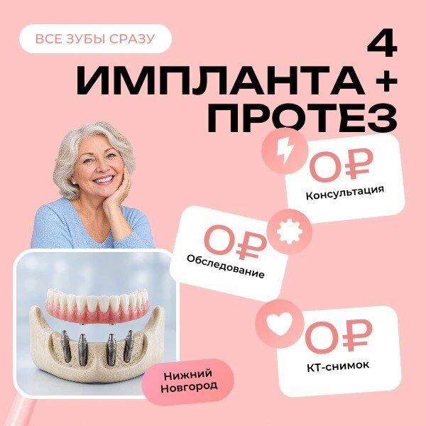Весь зубной ряд сразу на 4-х имплантах в Н.Новгороде.