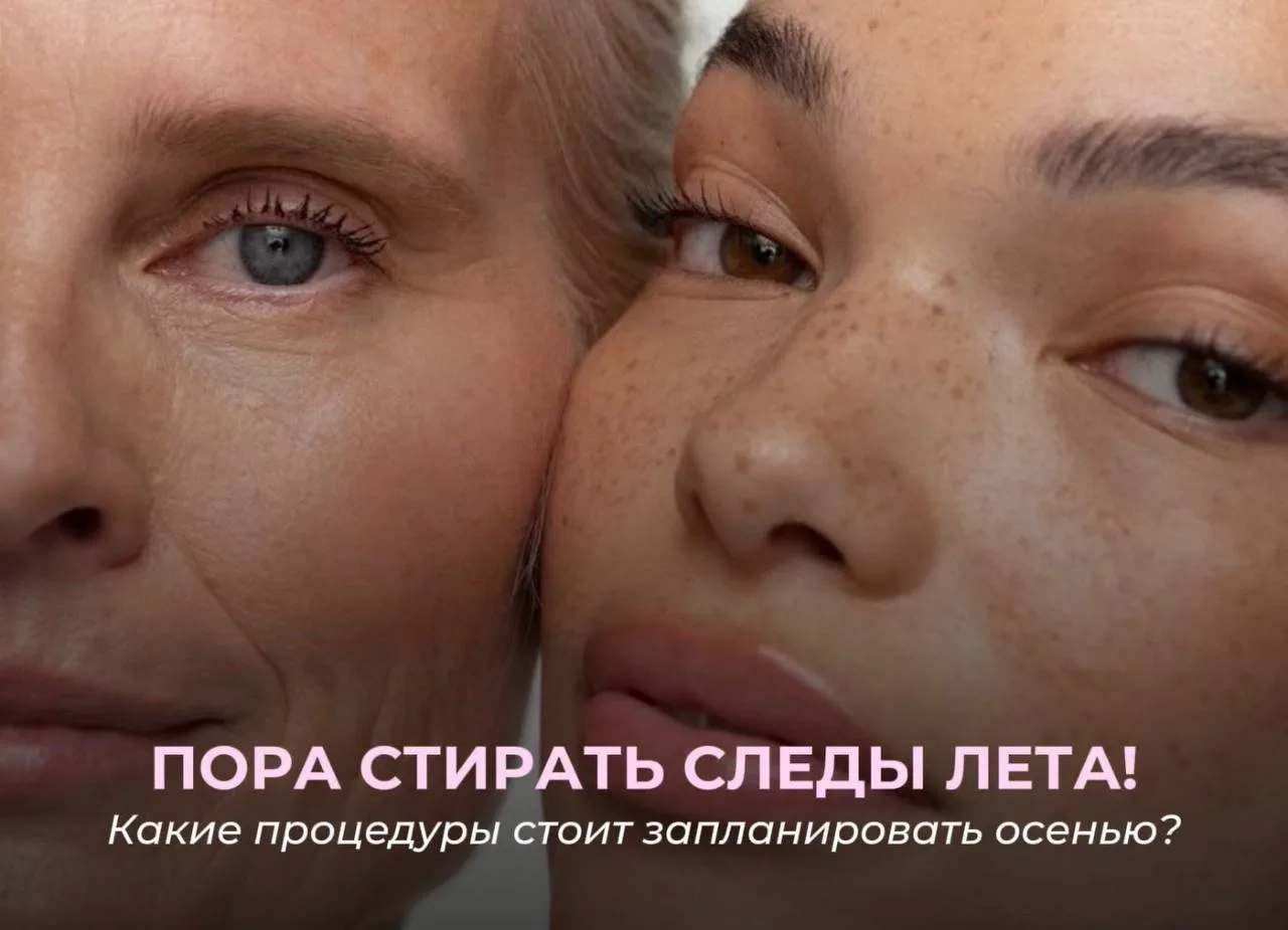 Лето закончилось. Его следы на коже — ещё нет 🍂