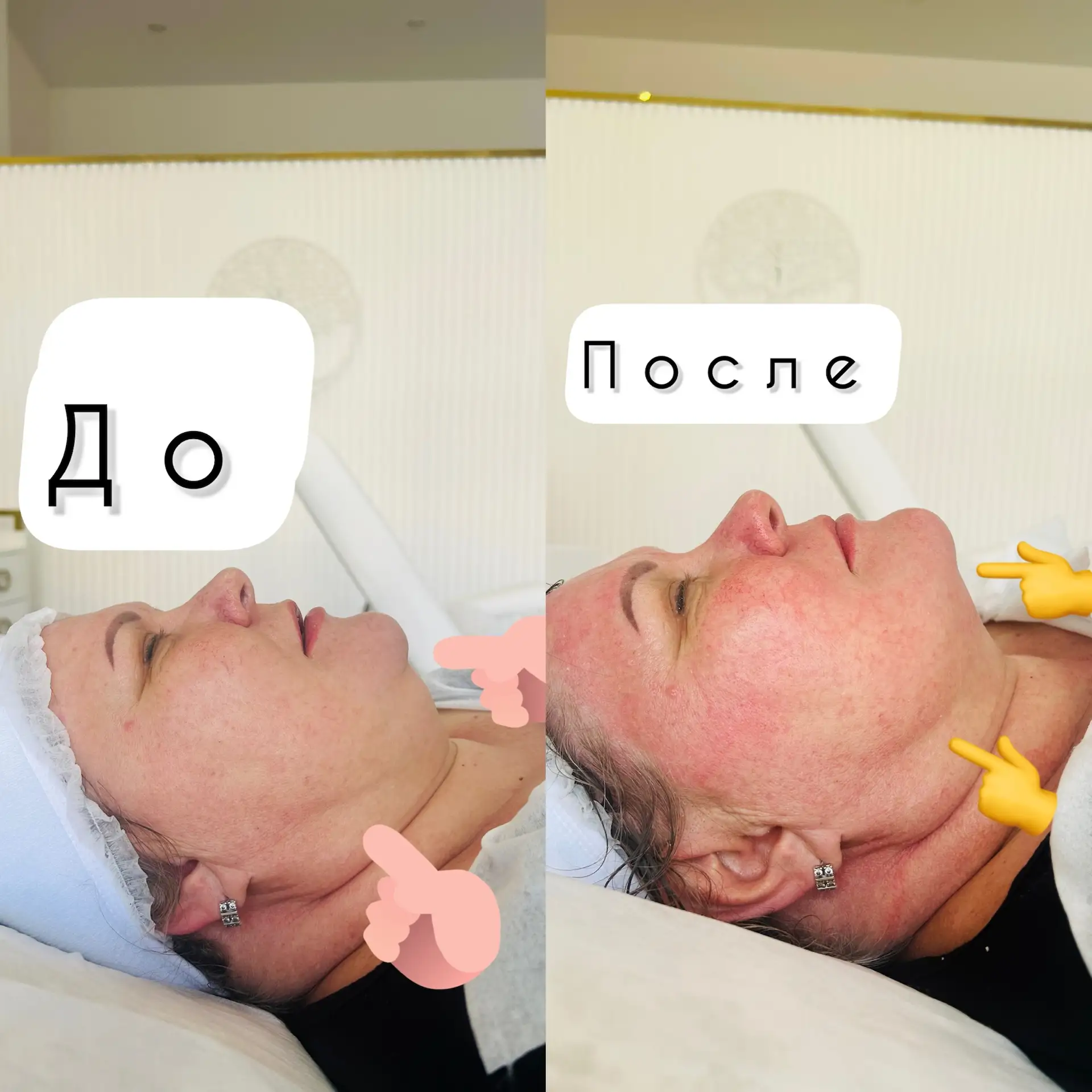 В «ПЬЕСЕ КРАСОТЫ» бескомпромиссная косметология, ноу-хау 2026 года🧬☝️