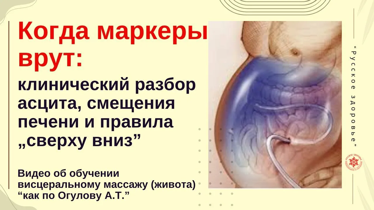 Когда маркеры врут: клинический разбор асцита, смещения печени и правила „сверху вниз”. Видео об обу
