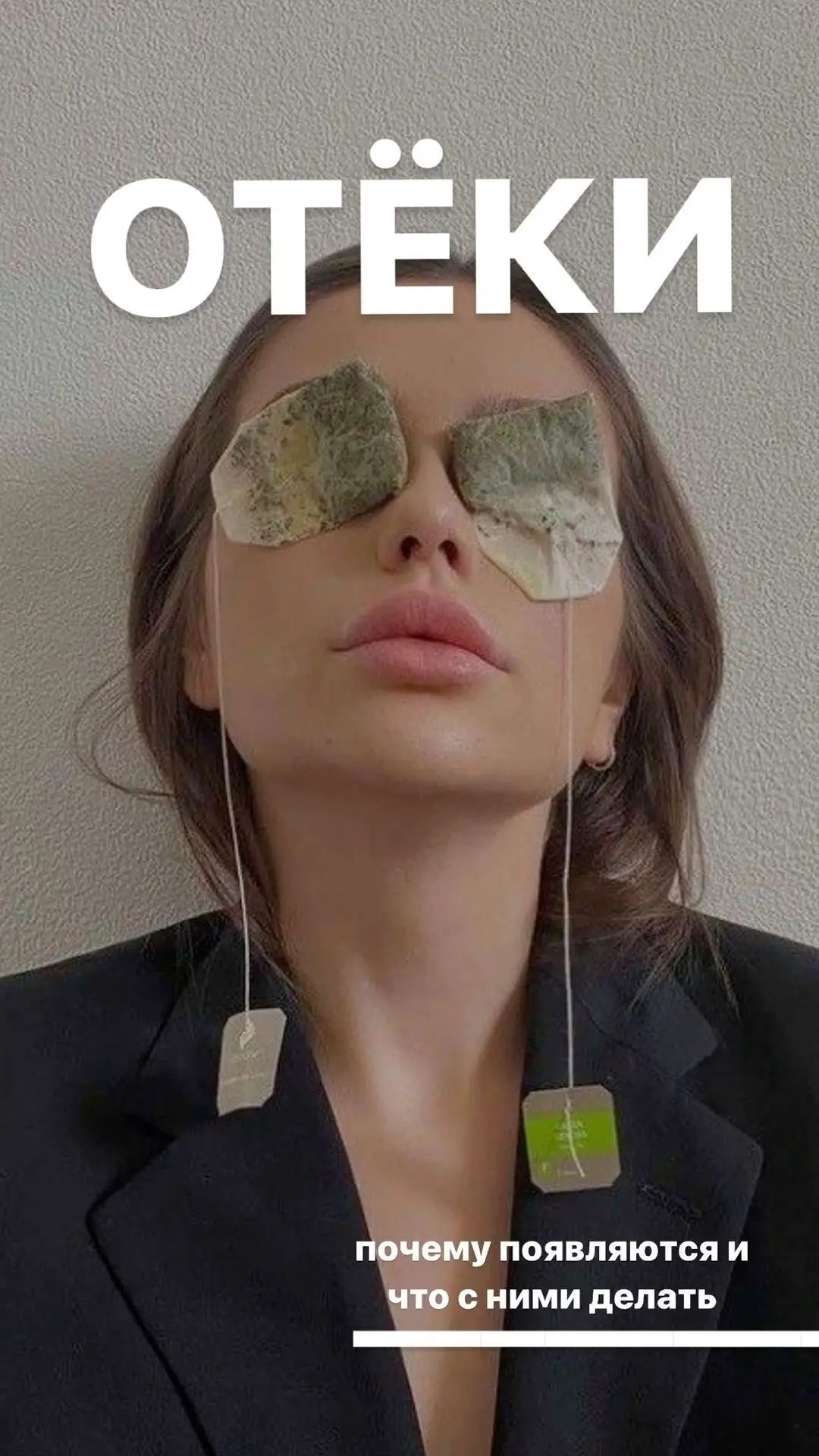 🚫 Отеки— это не всегда «выпила лишней воды на ночь». Разбираемся с причинами системно 🔍