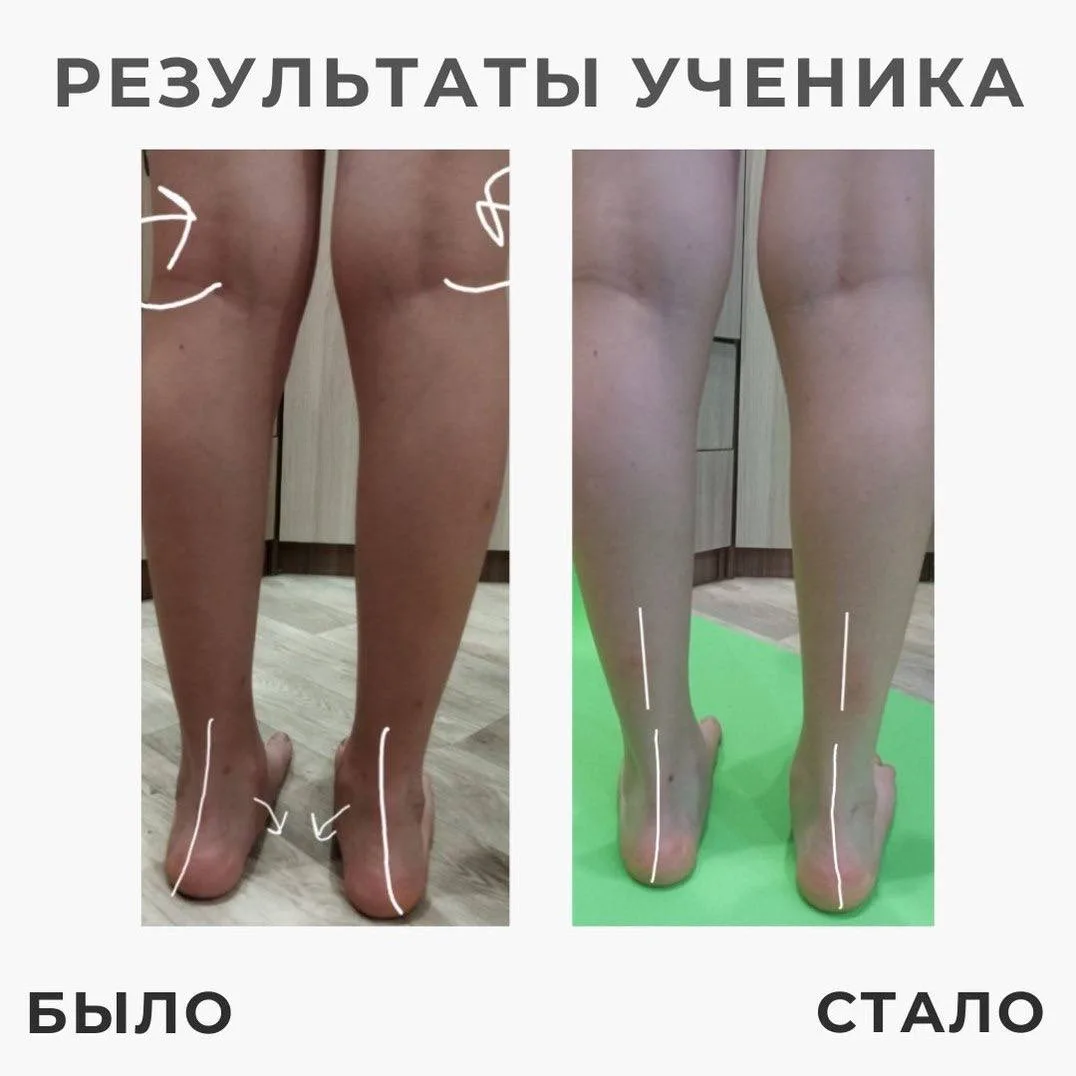 Просто посмотрите на РЕЗУЛЬТАТЫ НАШИХ УЧЕНИКОВ!🔥👆🏻  Мамы, которые перестали надеяться на то, что про