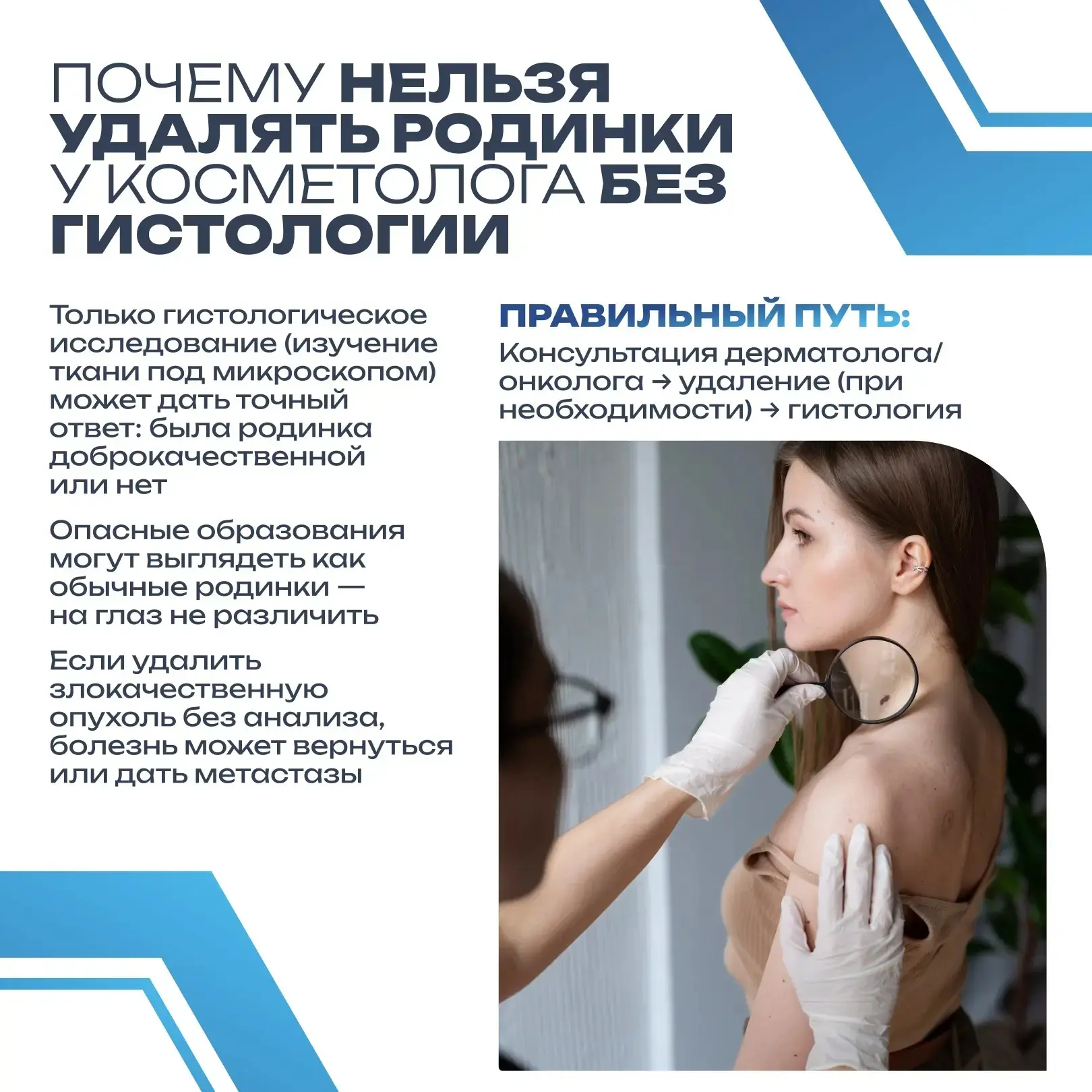 Родинки есть у каждого. Чаще всего они безобидны, но иногда сигнализируют об опасном за...