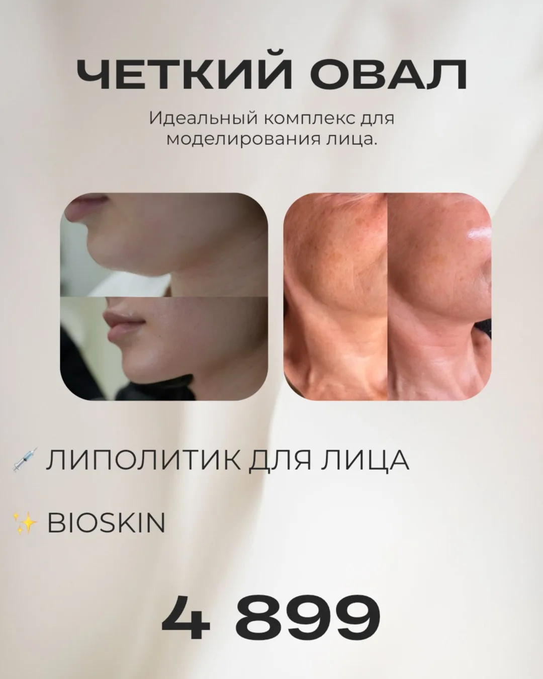💎 ЧЕТКИЙ ОВАЛ