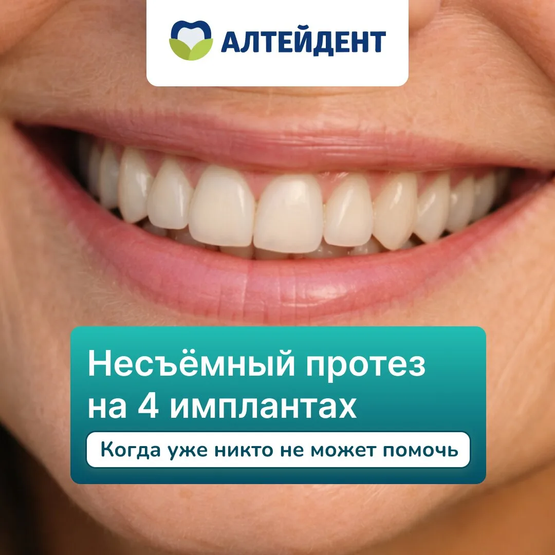 Главные ошибки при выборе клиники для имплантации зубов