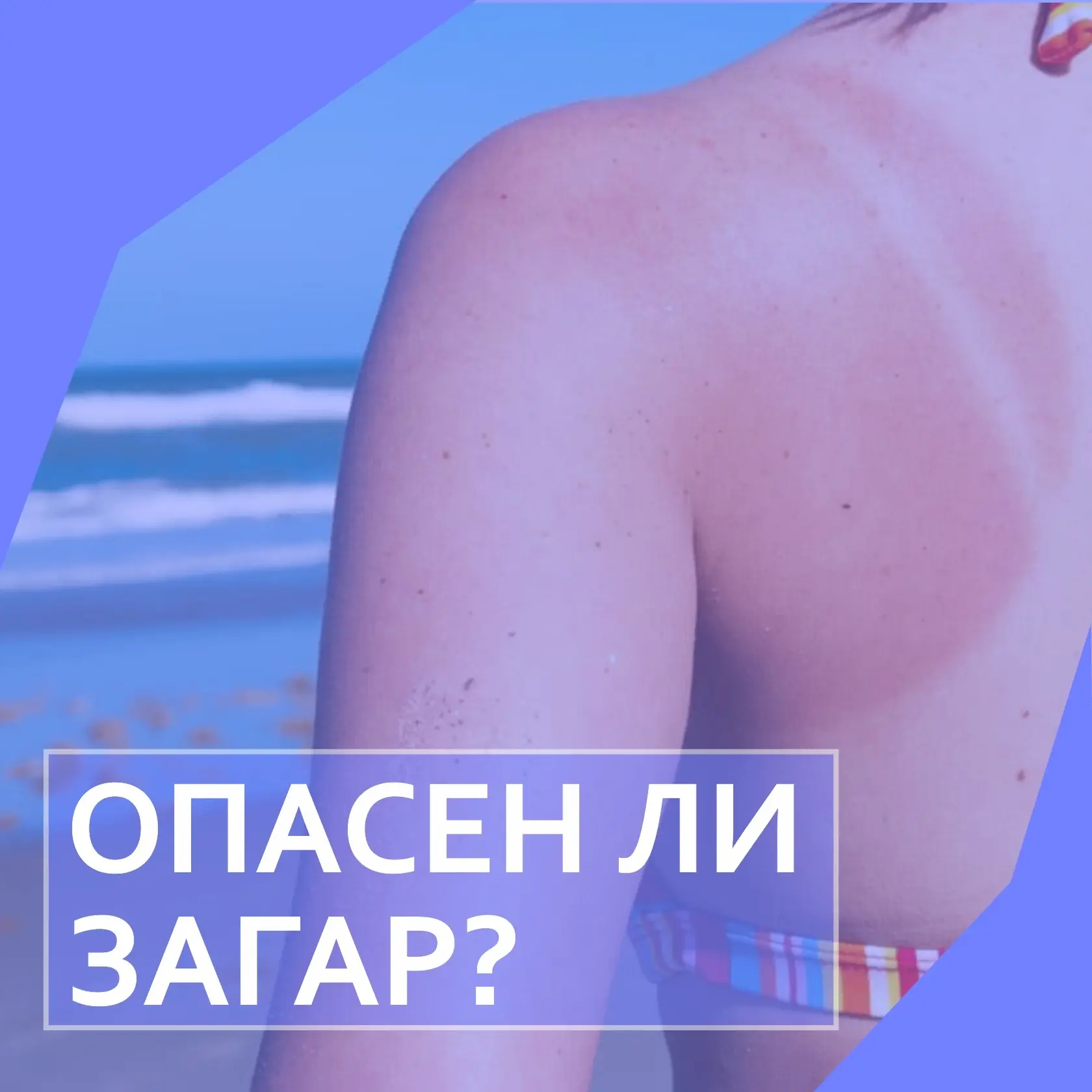 Лето в разгаре, многие ходят на пляж позагорать
Рассказываем, как сделать отдых безопасным и загорат
