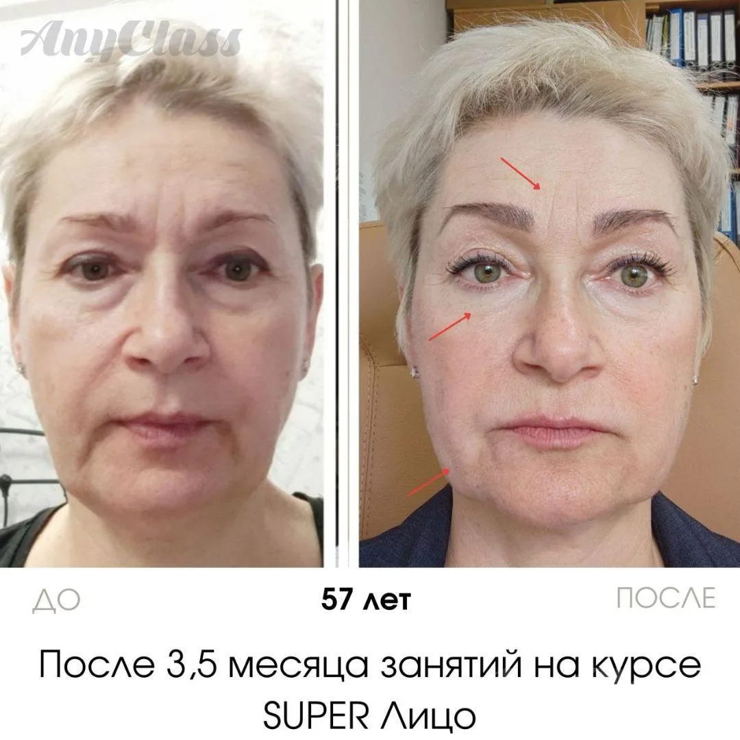 «Я не верю в гимнастику для лица! И не верю, что вы ничего с собой не делали» ⚠️ Гимнастика для лица