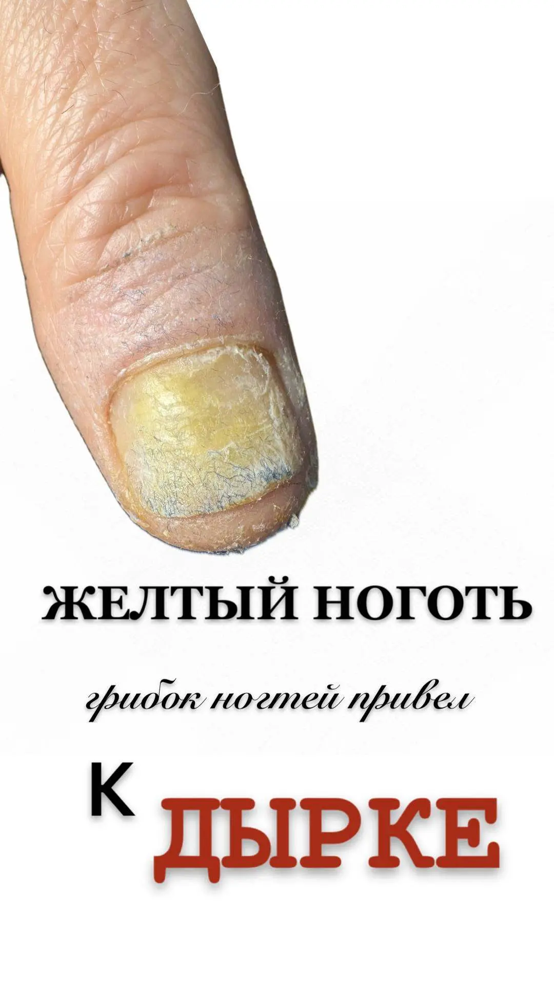 Пациентка которая зарабатывает деньги честным трудом на производстве продуктов .