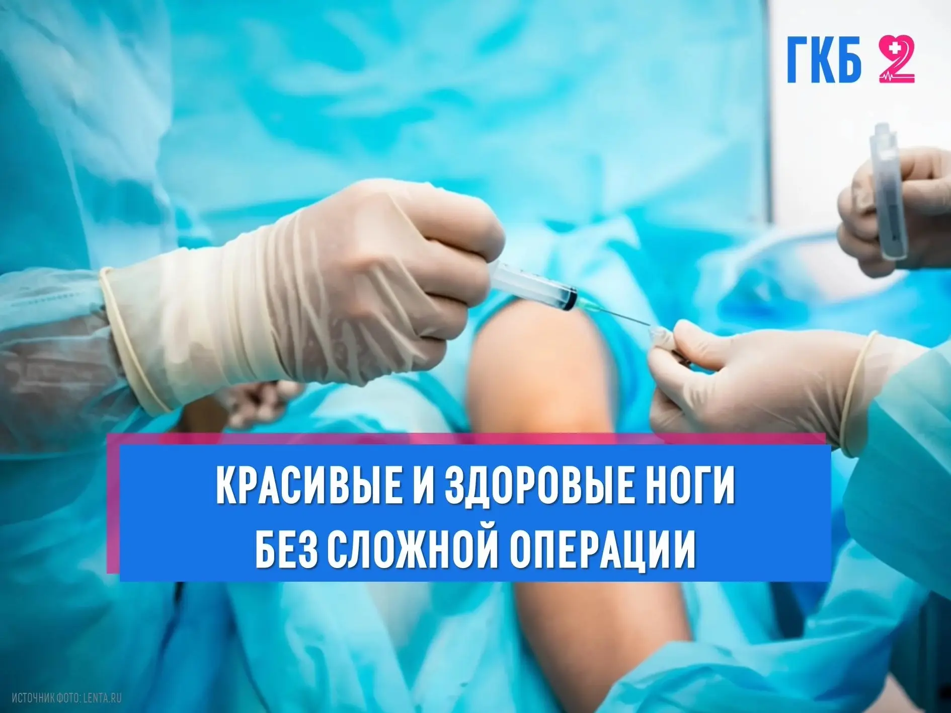 Сосудистые звездочки, сеточки и варикозное расширение вен — проблема, которая беспокоит...