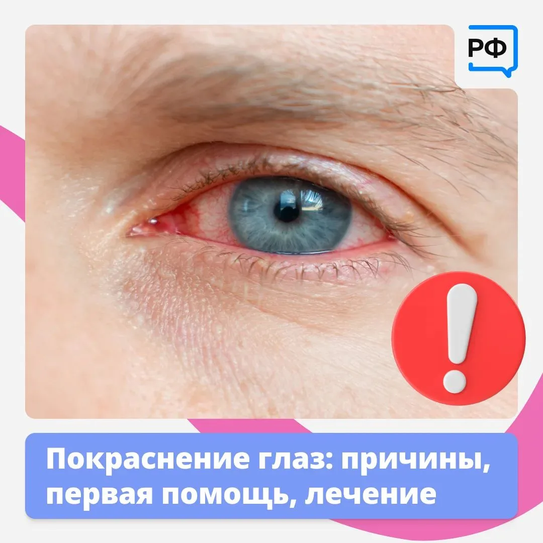 👀 Красные глаза — это красный флаг! Они прямо сигнализируют: пора обратить на них вним...