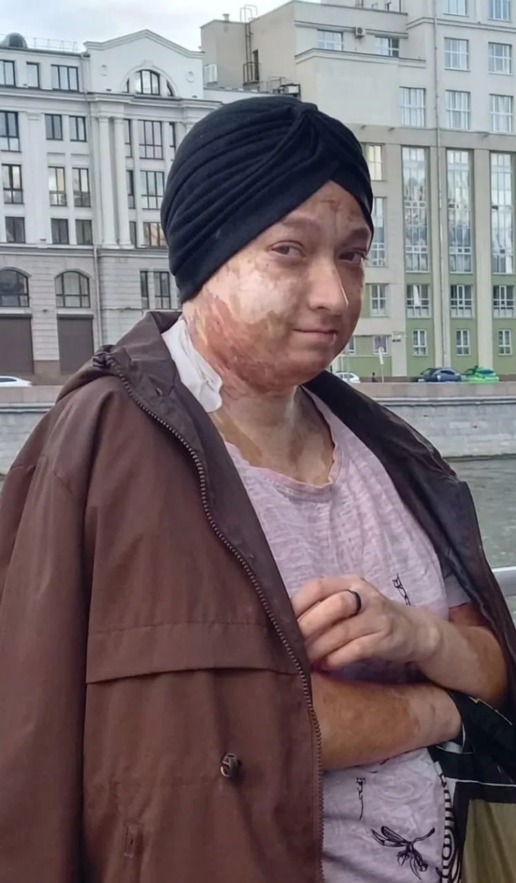 Благодаря вам раны на коже заживают, зуд уменьшился, и Регина может спать ночами